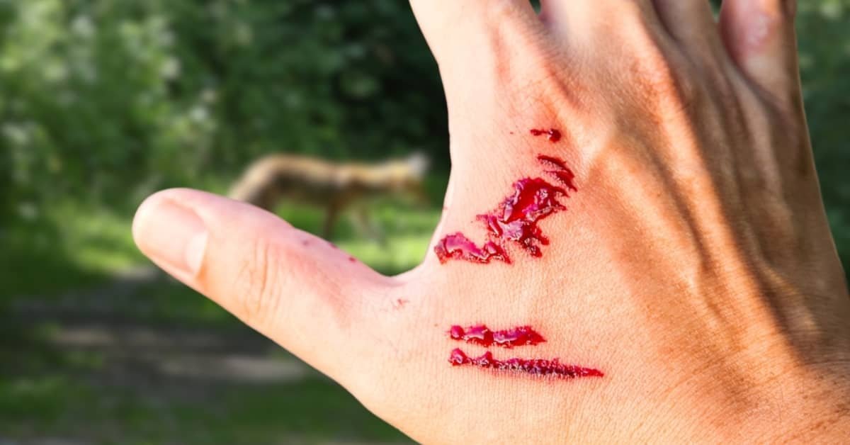 how dangerous are dog bites